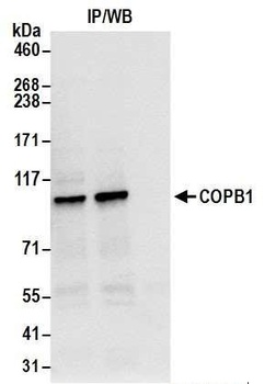 Rabbit anti-COPB1 Antibody
