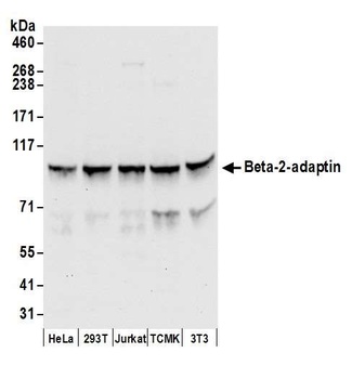Beta-2-adaptin Antibody