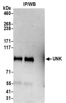 UNK Antibody