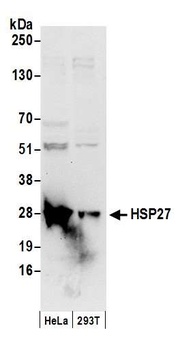 HSP27 Antibody