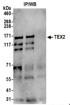 TEX2 Antibody