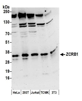 ZCRB1 Antibody