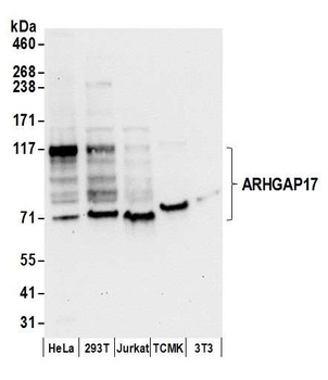 Rabbit anti-ARHGAP17 Antibody