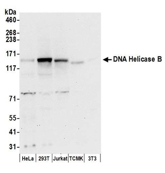 DNA Helicase B Antibody