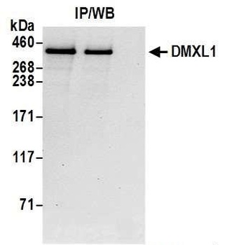 DMXL1 Antibody