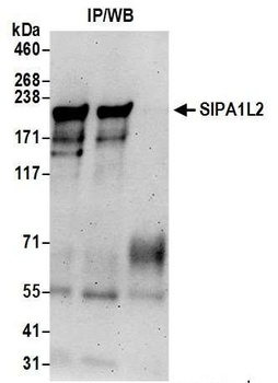 SIPA1L2 Antibody