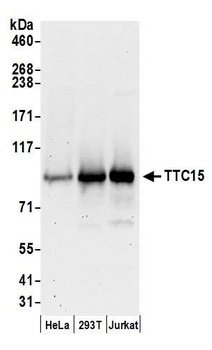 TTC15 Antibody