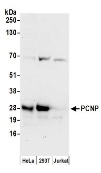 Rabbit anti-PCNP Antibody