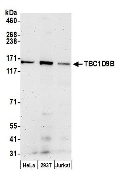 TBC1D9B Antibody
