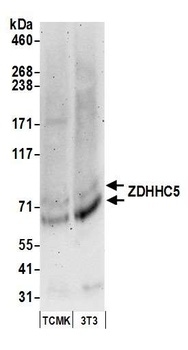 ZDHHC5 Antibody