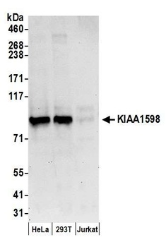 KIAA1598 Antibody
