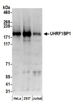 UHRF1BP1 Antibody