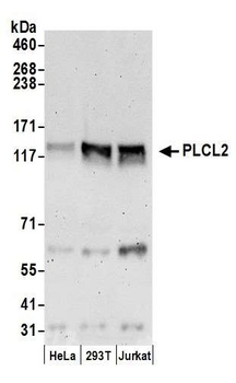 PLCL2 Antibody