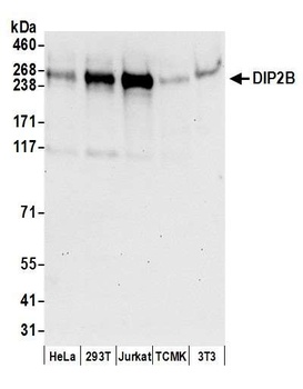DIP2B Antibody