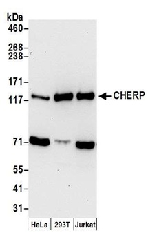 Rabbit anti-CHERP Antibody