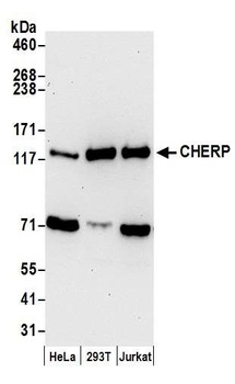 CHERP Antibody