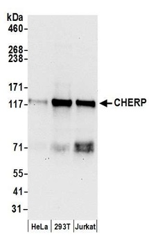 CHERP Antibody