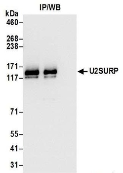 Rabbit anti-U2SURP Antibody