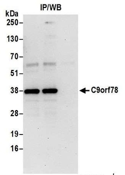 C9orf78 Antibody