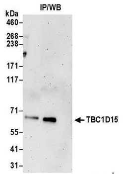 TBC1D15 Antibody