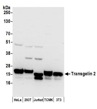 Transgelin 2 Antibody