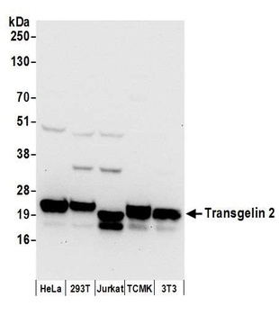 Rabbit anti-Transgelin 2 Antibody