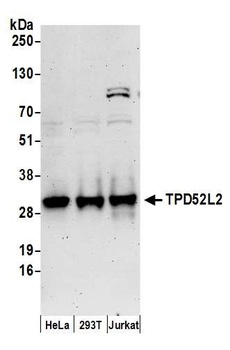 TPD52L2 Antibody