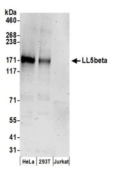 LL5beta Antibody