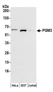 PGM3 Antibody