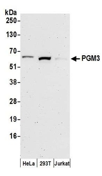 Rabbit anti-PGM3 Antibody