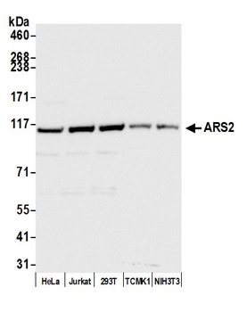 ARS2 Antibody