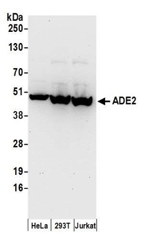 ADE2 Antibody