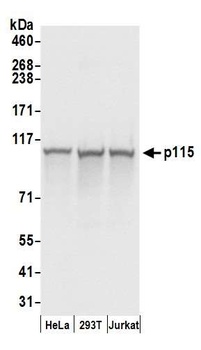 p115 Antibody