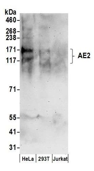 Rabbit anti-AE2 Antibody