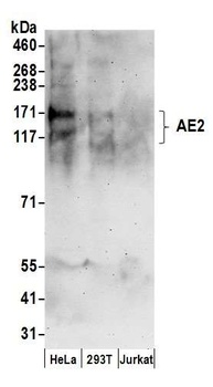 AE2 Antibody