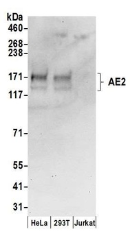 Rabbit anti-AE2 Antibody