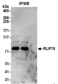 RLIP76 Antibody