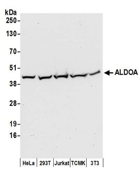 ALDOA Antibody