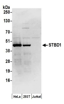 Rabbit anti-STBD1 Antibody