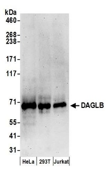 DAGLB Antibody