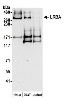 Rabbit anti-LRBA Antibody