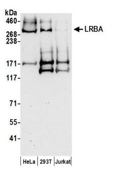 LRBA Antibody