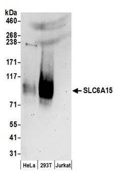 SLC6A15 Antibody