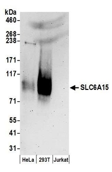 Rabbit anti-SLC6A15 Antibody