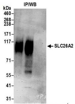 Rabbit anti-SLC26A2 Antibody