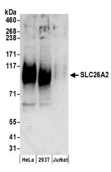 SLC26A2 Antibody
