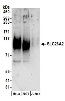 Rabbit anti-SLC26A2 Antibody