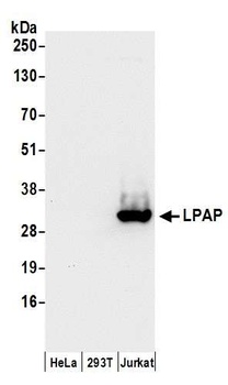 Rabbit anti-LPAP Antibody