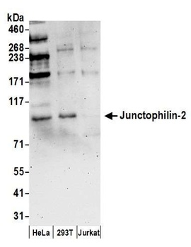 Junctophilin-2 Antibody
