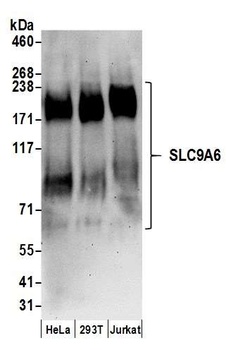 SLC9A6 Antibody